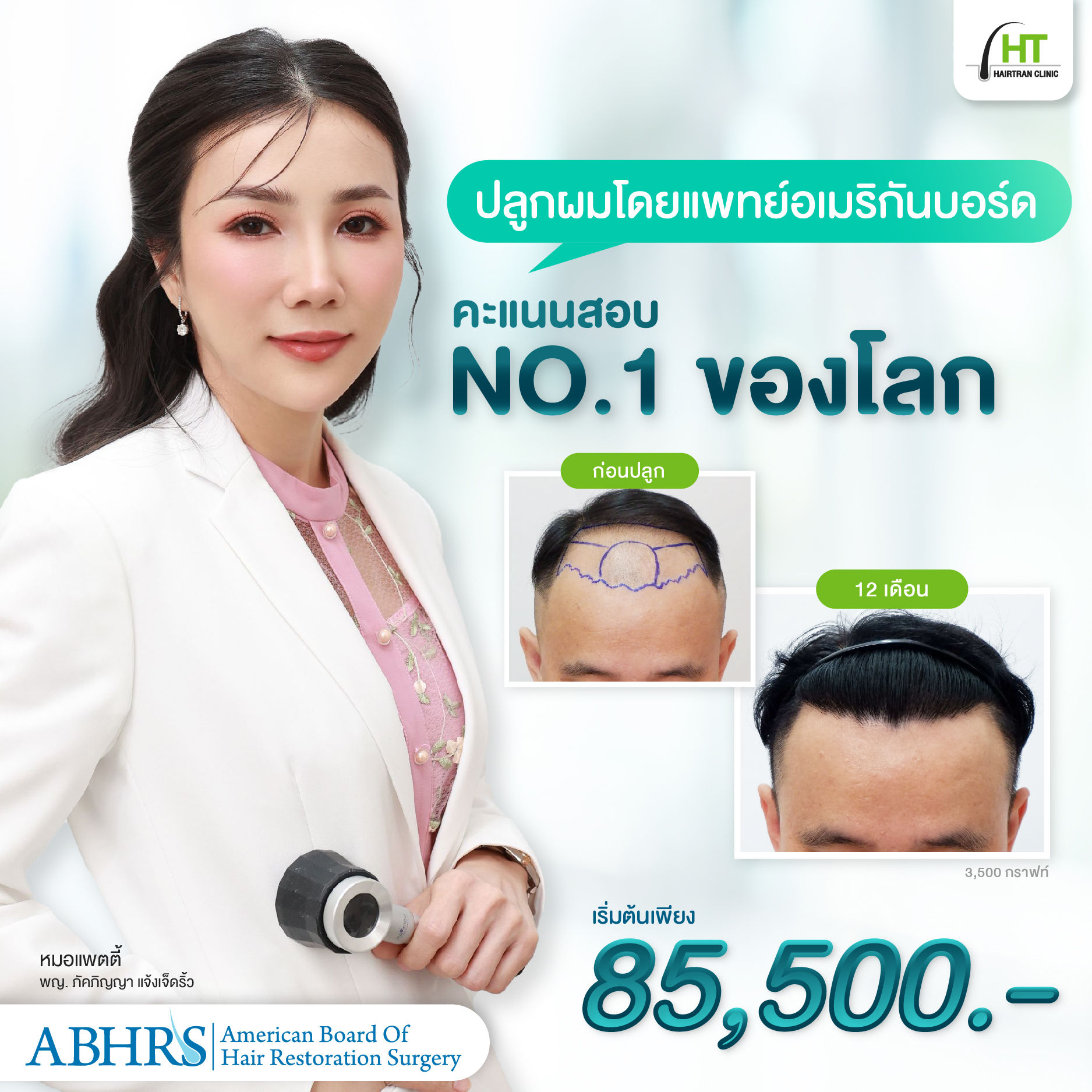 ปลูกผมราคา