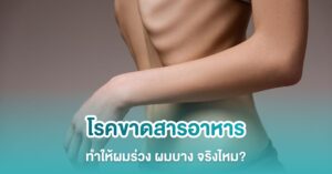 โรคขาดสารอาหารทำให้ผมร่วง