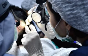 ปลูกผมด้านหน้า