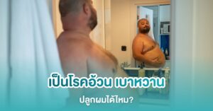 โรคอ้วน เบาหวาน ปลูกผมได้ไหม