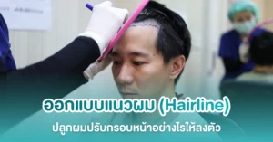 ออกแบบแนวผม ปลูกผมปรับกรอบหน้า