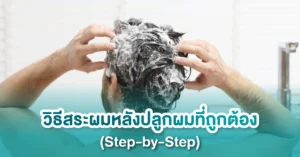 วิธีสระผมหลังปลูกผมที่ถูกต้อง