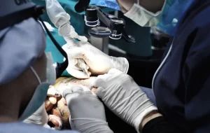 ปลูกผม Hairtran