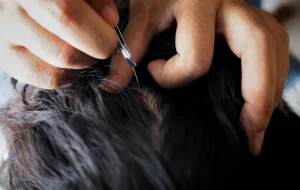 ผมหงอก ยิ่งถอนยิ่งขึ้น