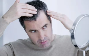 วิธีแก้ผมร่วง