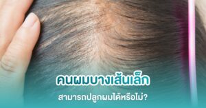 ผมบางเส้นเล็ก ปลูกผมได้ไหม