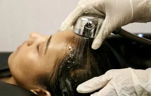 สระผมหลังปลูกผม