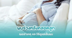 ผมร่วงหลังคลอด