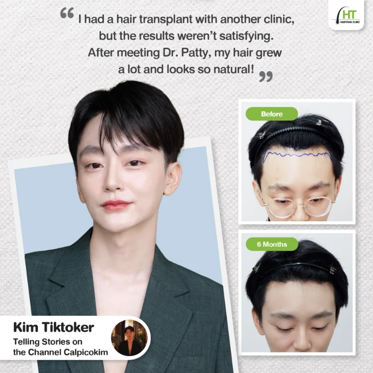 Hairtran Clinic influencer