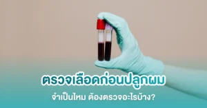 ทำไมต้องตรวจเลือดก่อนปลูกผม