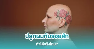 ปลูกผมทับรอยสัก