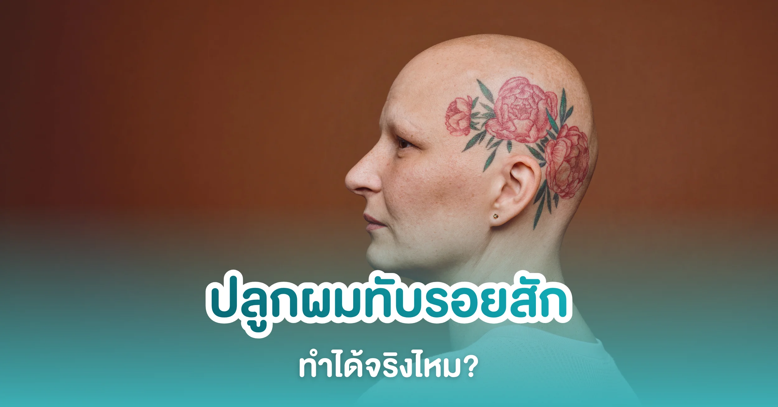 ปลูกผมทับรอยสัก ทำได้จริงหรือไม่? อยากรักษาผมร่วง ผมบางต้องรู้