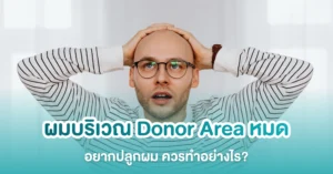 ไม่มีผม ปลูกผมได้ไหม