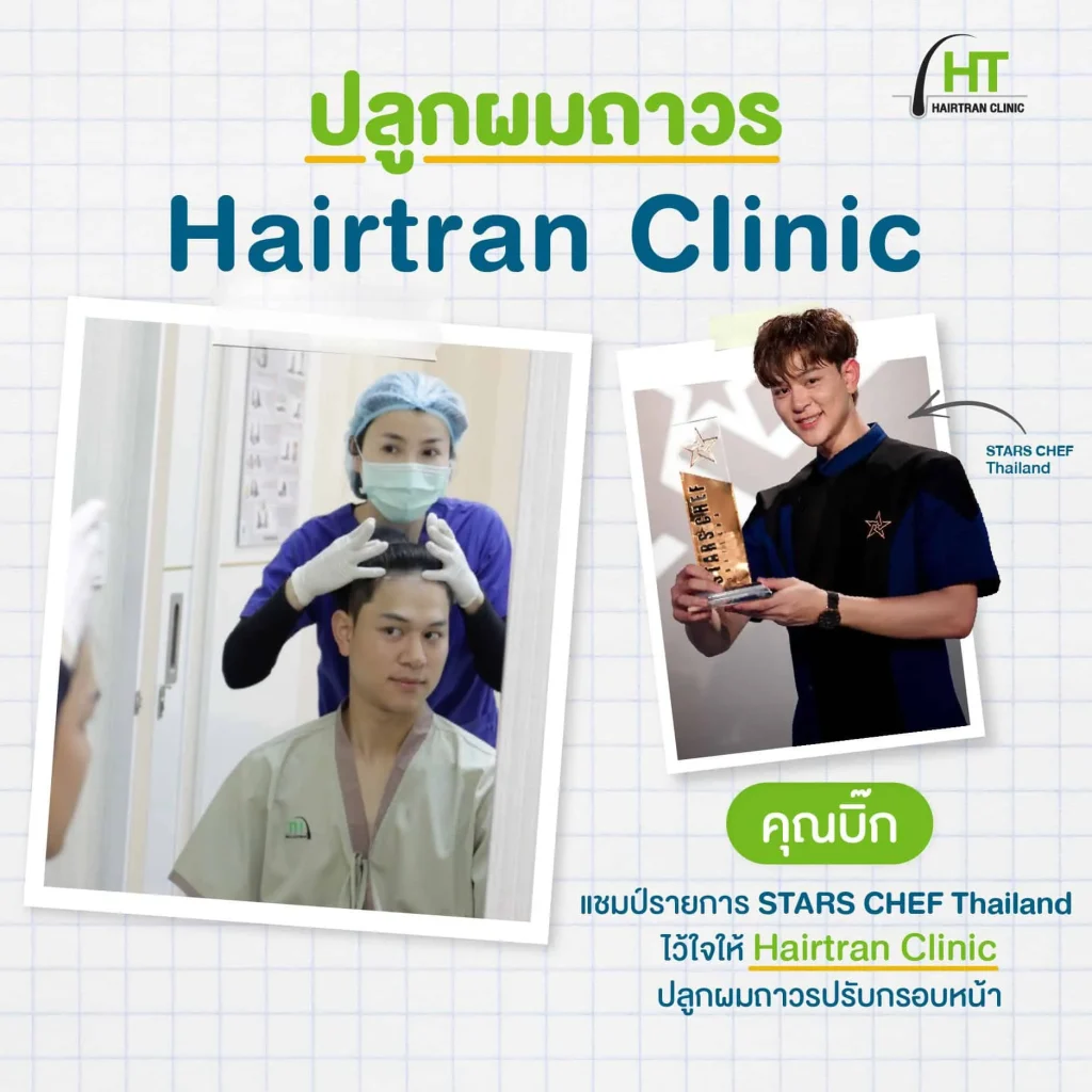 ปลูกผมถาวร Hairtran Clinic