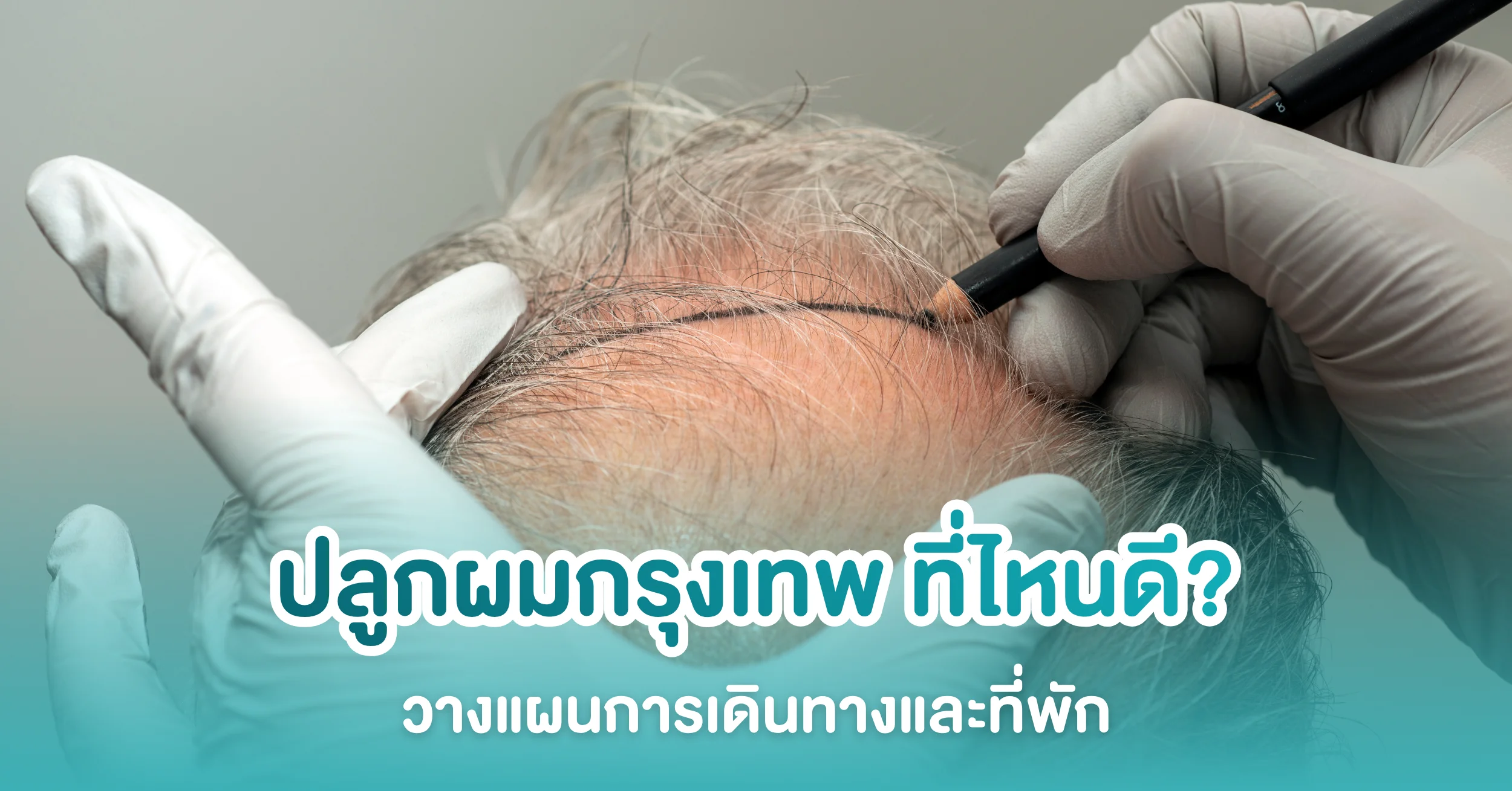 ปลูกผมกรุงเทพ ปลูกที่ไหนดี? คู่มือวางแผนการเดินทางและที่พัก
