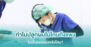 ทำไมราคาปลูกผมถึงแพง