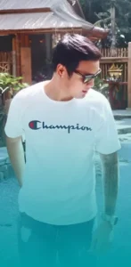 รีวิวปลูกผม คุณกัน