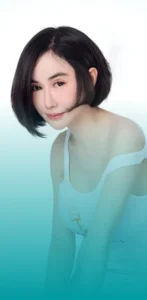 รีวิวปลูกผม คุณพอลลี่