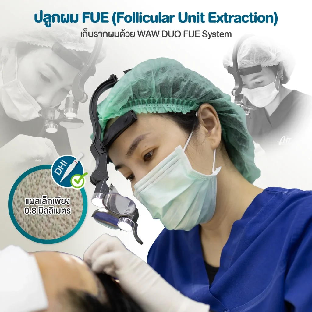 ปลูกผม FUE