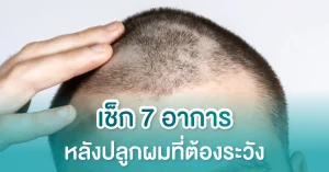 อาการหลังปลูกผม