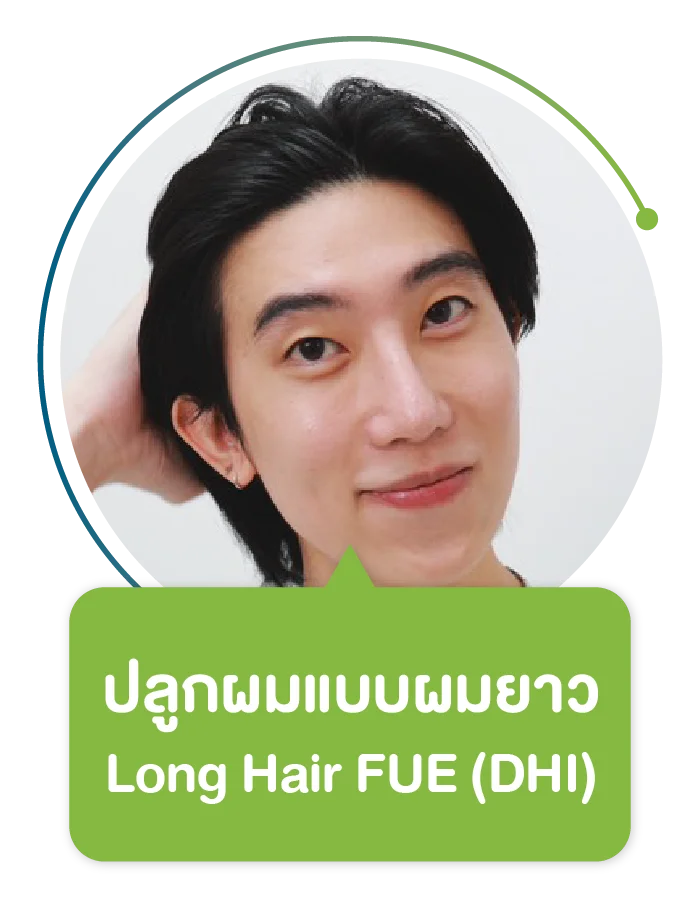 ปลูกผมยาว Long Hair