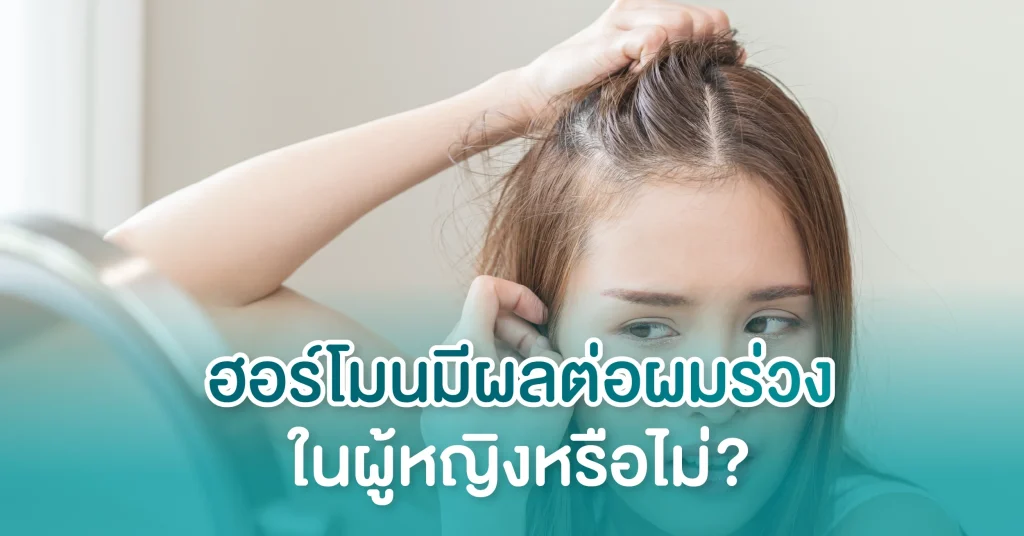 ผมร่วงในผู้หญิง
