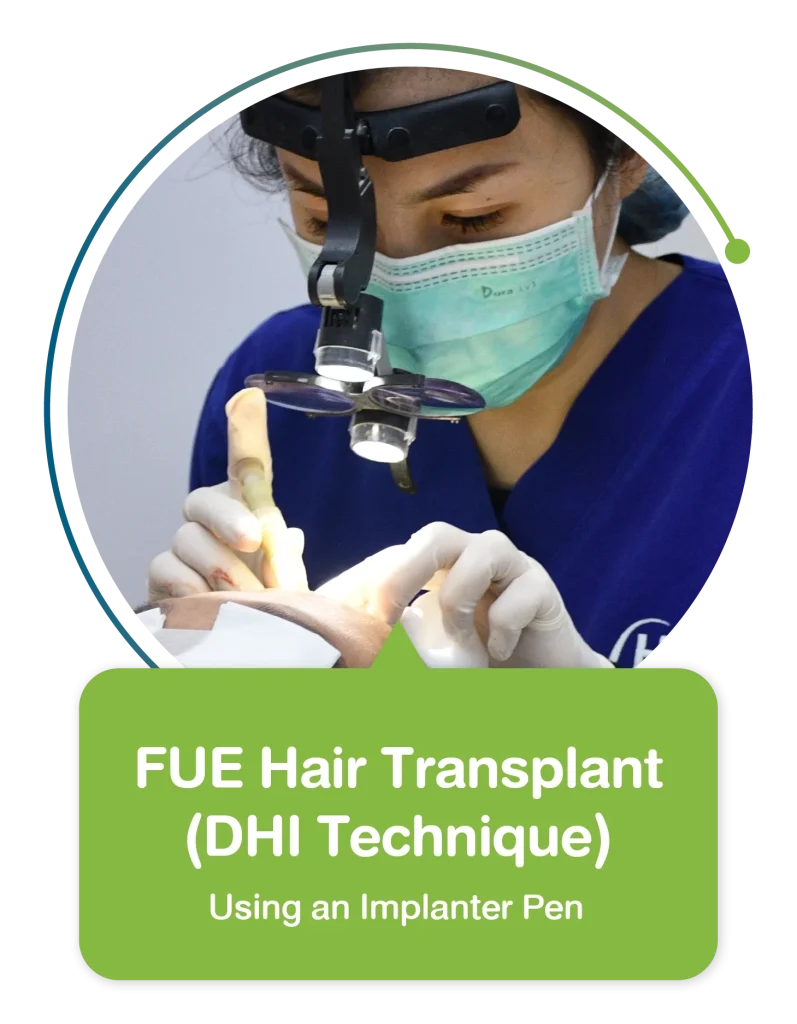 FUE Hair Transplant