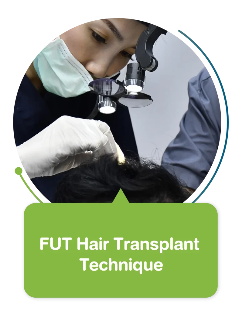 FUT Hair Transplant