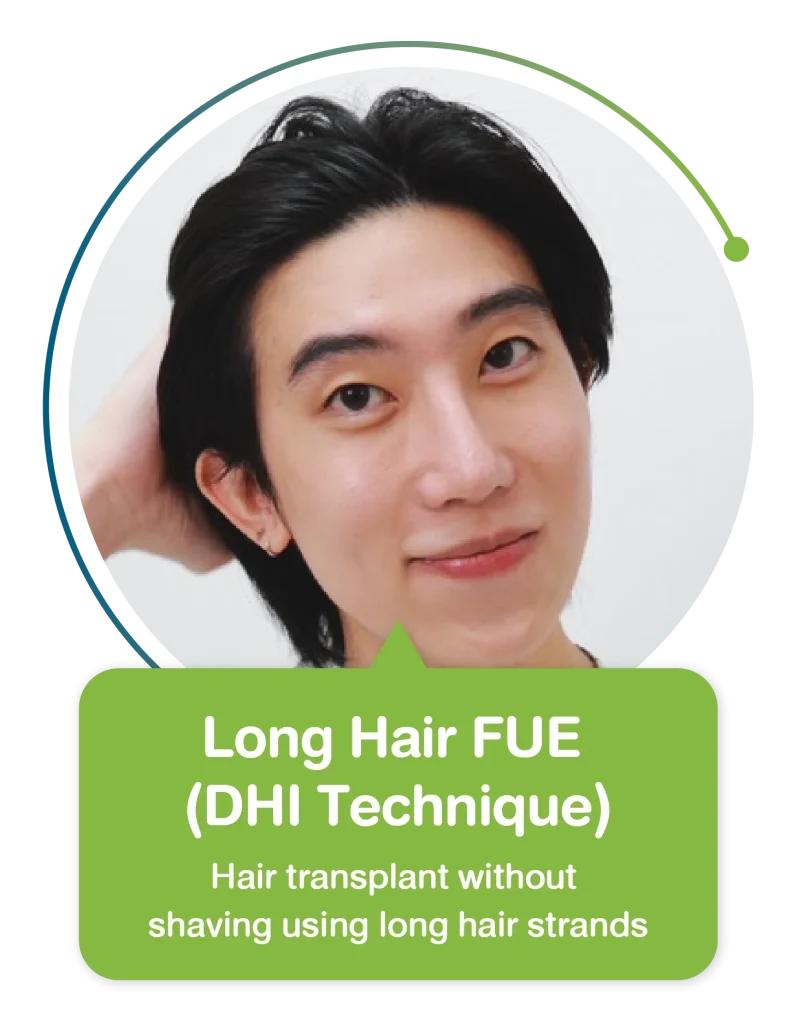 Long Hair FUE (DHI)