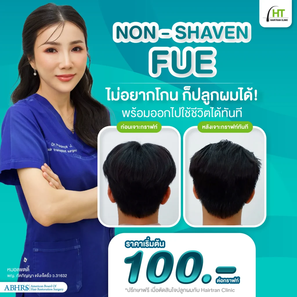 ราคาปลูกผมแบบไม่โกน