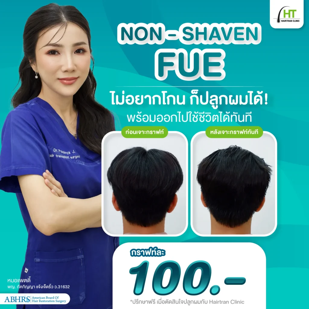 ราคาปลูกผมแบบไม่ต้องโกน