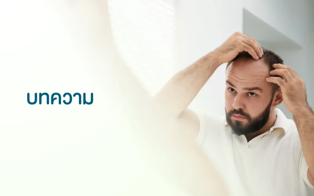 บทความปลูกผม