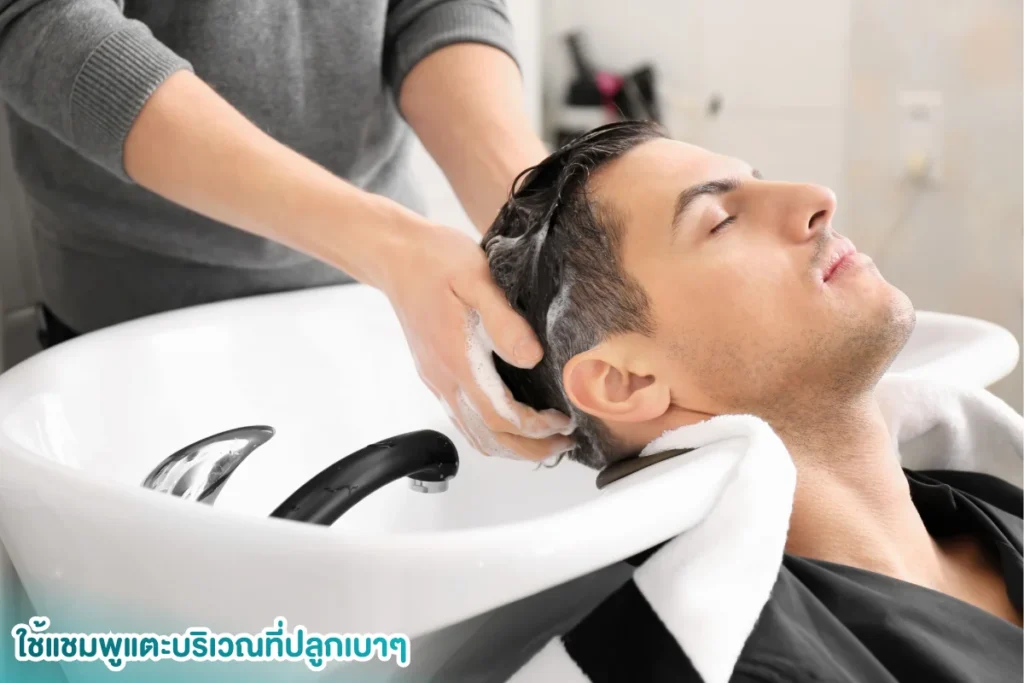 วิธีจัดการสะเก็ดหลังปลูกผม