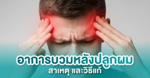 อาการบวมหลังปลูกผม