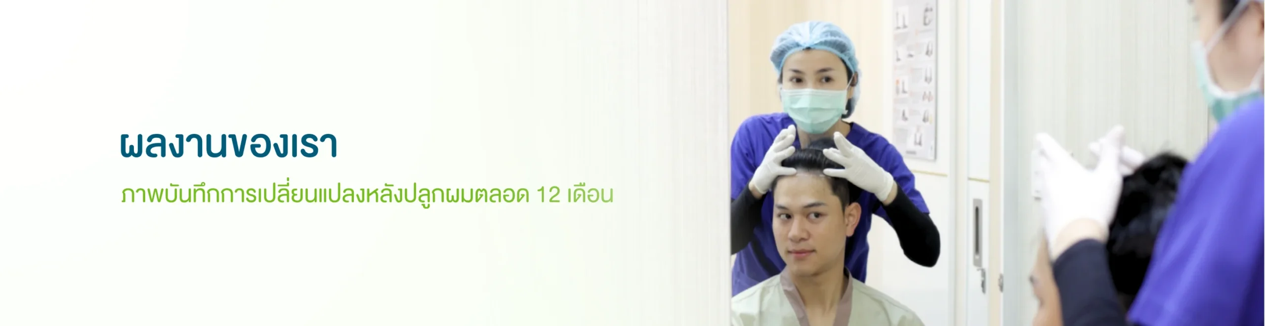 ผลงานปลูกผม