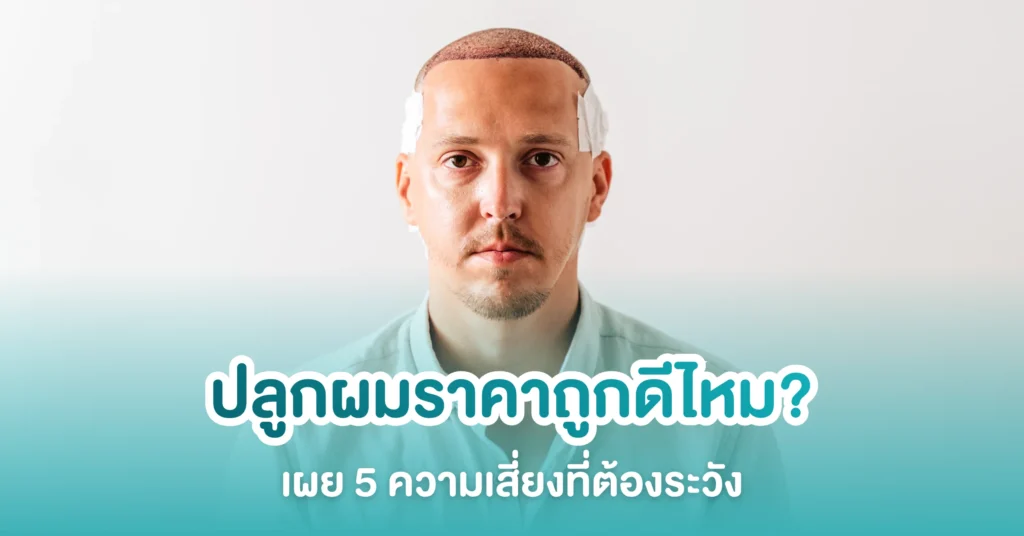 ปลูกผมราคาถูก