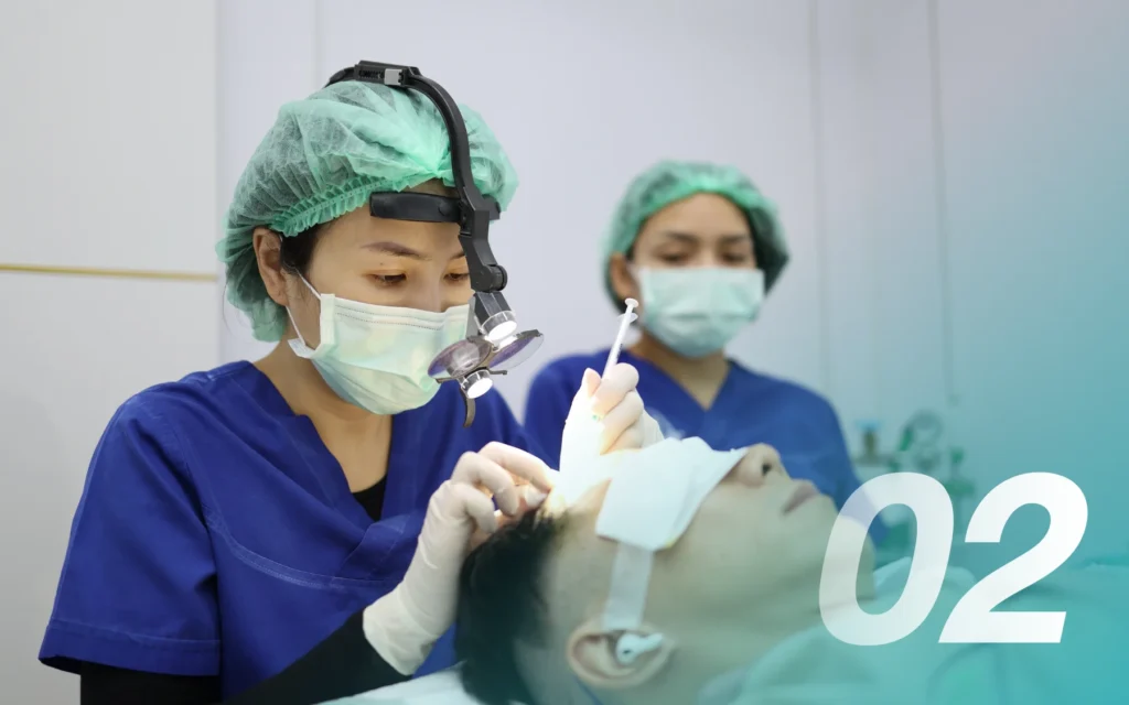 Q&A ปลูกผม