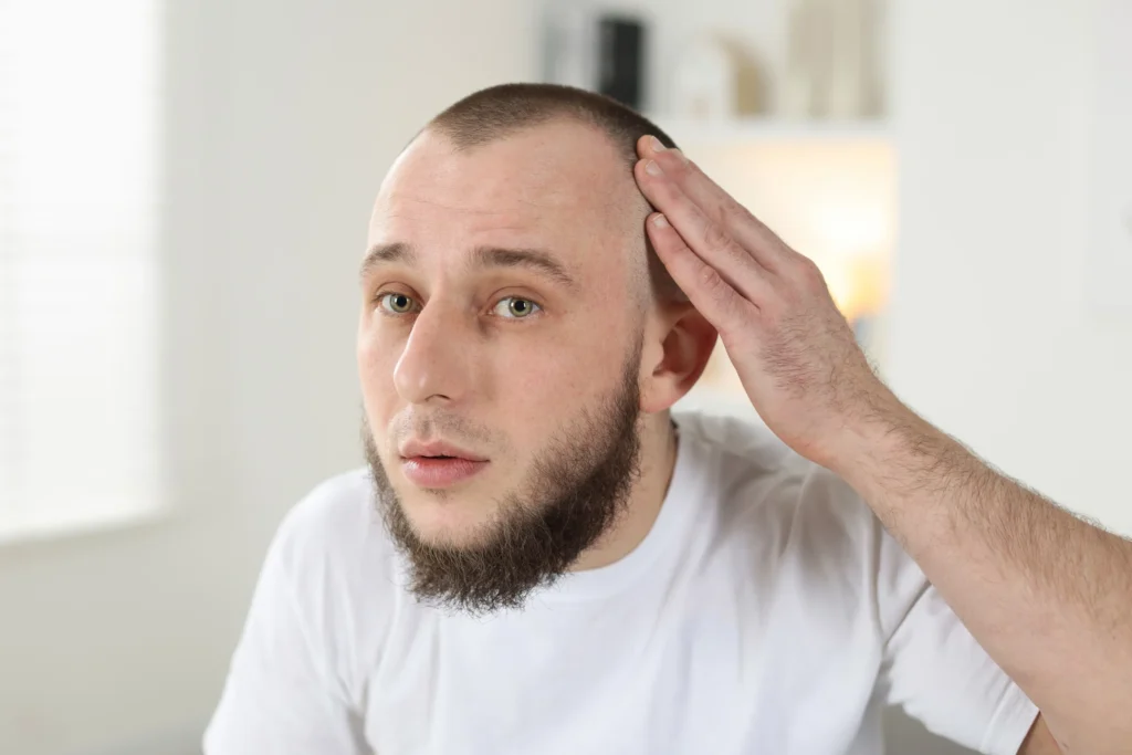 ปลูกผมราคาถูก แนวไรผมดูไม่เป็นธรรมชาติ