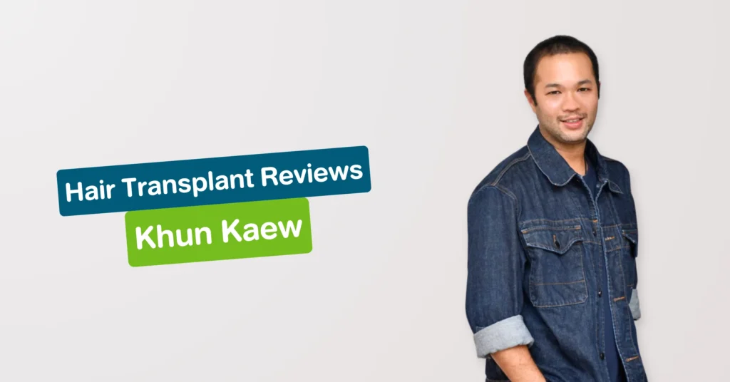Hair Transplant Review Khun Kaew Hairtran Clinic