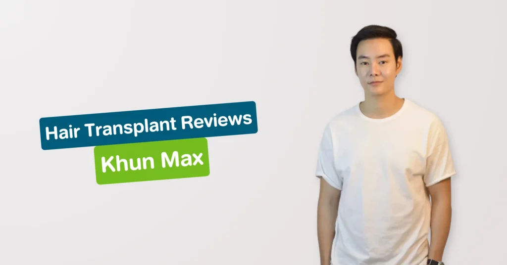 Hair Transplant Review Khun Max Hairtran Clinic