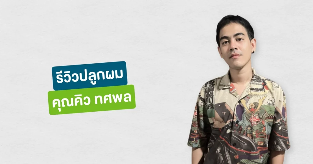 รีวิวปลูกผมที่ Hairtran Clinic เคสคุณคิว ทศพล