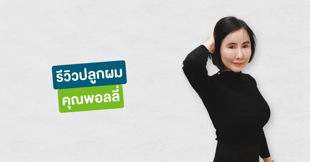 รีวิวปลูกผมที่ Hairtran Clinic เคสคุณพอลลี่