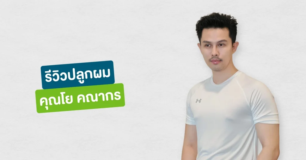 รีวิวปลูกผมที่ Hairtran Clinic เคสคุณโย คณากร