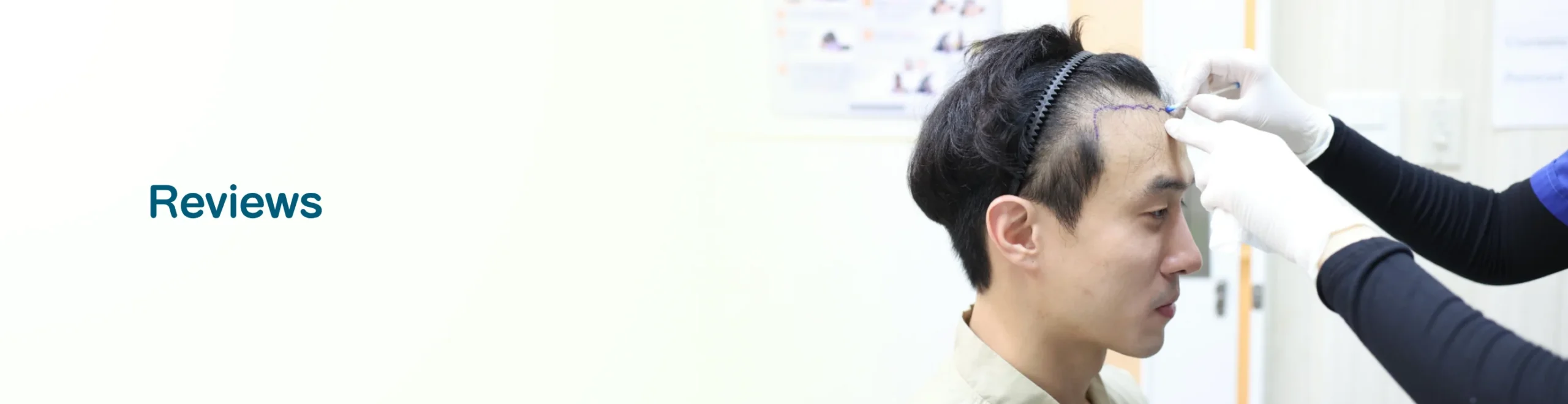 Hair Transplant Reviews Hairtran Clinic