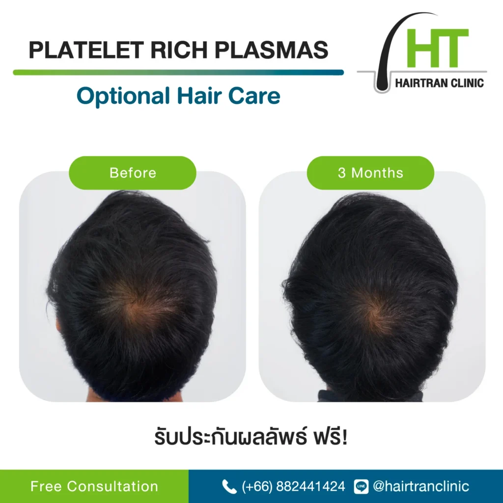 Hair Treatment