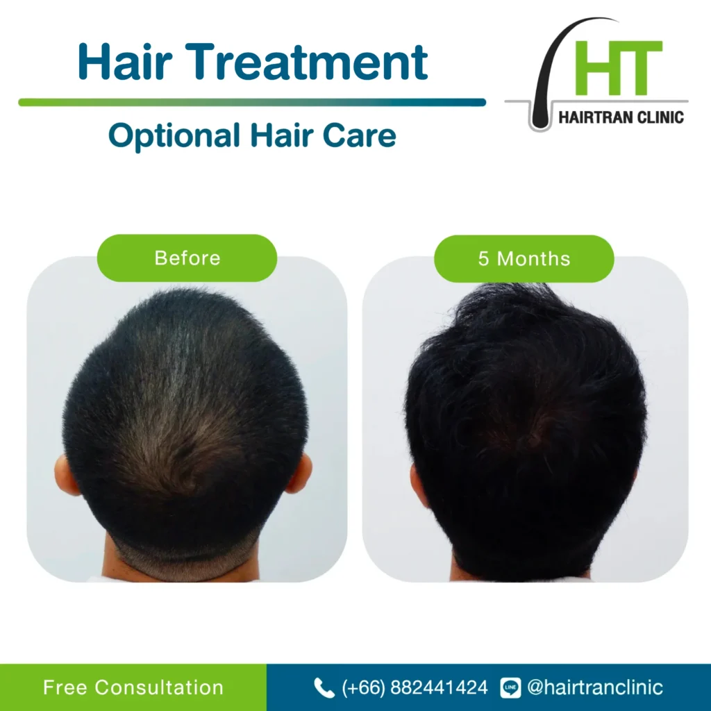 Optional Hair Care: Hair treatment