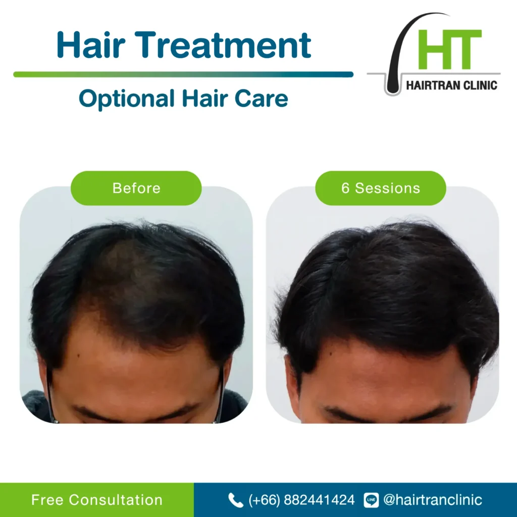 Hair treatment