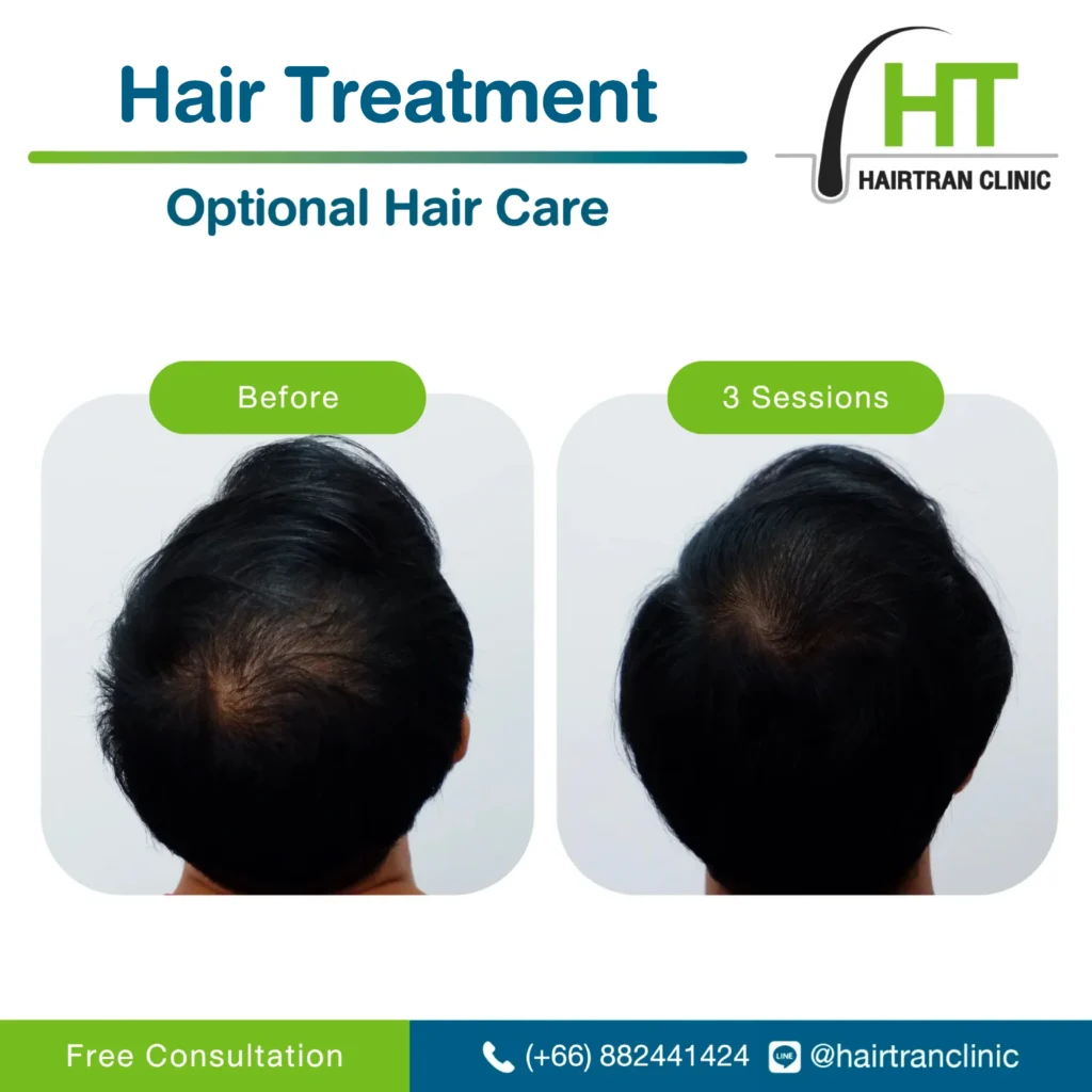 Hair treatment