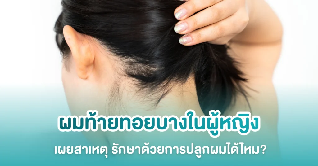 ผมท้ายทอยบาง