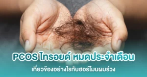 ฮอร์โมนผมร่วง